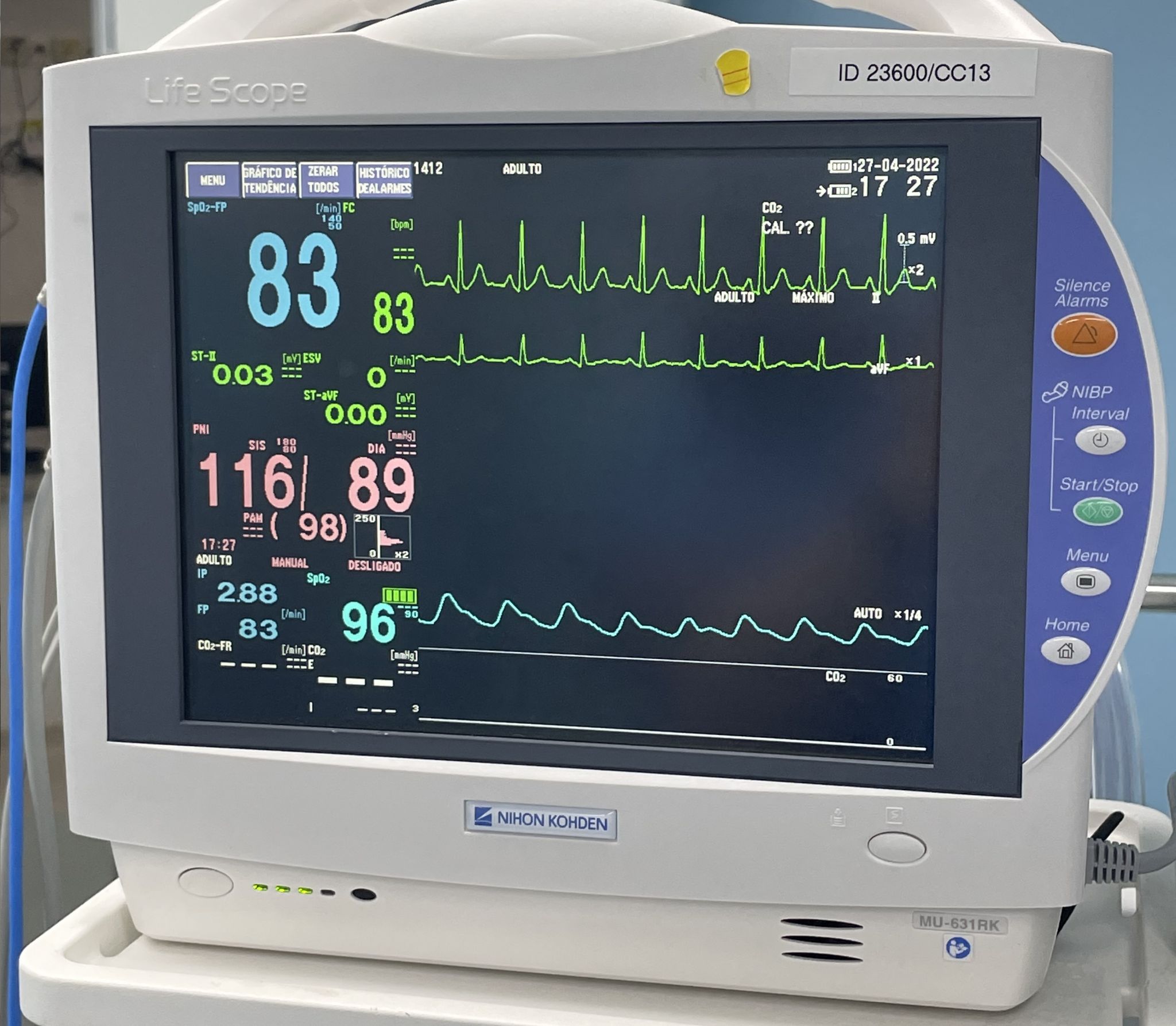 Monitor multiparamétrico utilizado na aferição e captação dos sinais vitais do paciente